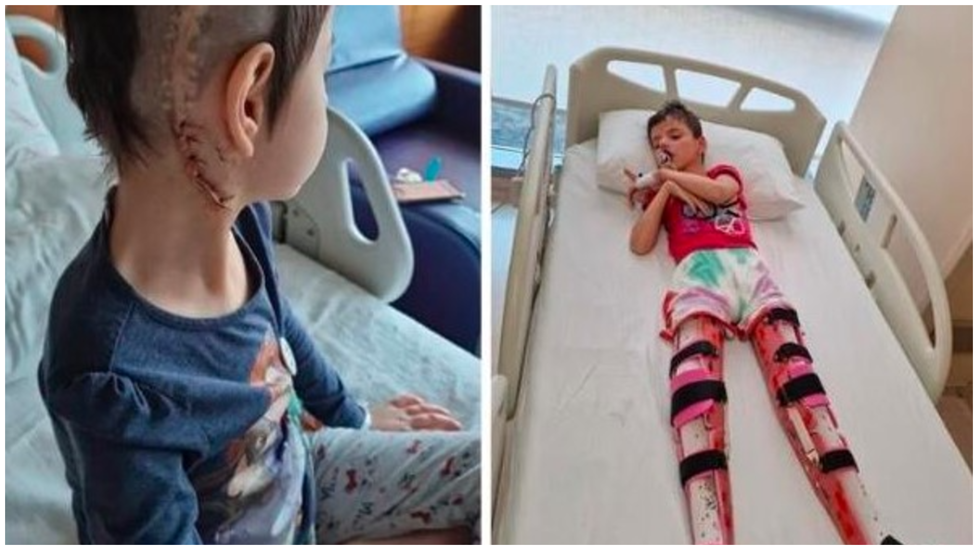 Hrabroj Medini potrebna 32. operacija mozga – pomozimo joj da nastavi borbu za život!